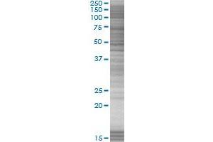 GTF2B transfected lysate. (GTF2B 293T Cell Transient Overexpression Lysate(Denatured))