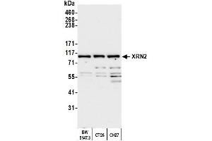 Western Blotting (WB) image for anti-5'-3' Exoribonuclease 2 (XRN2) (AA 900-950) antibody (ABIN7454718) (XRN2 Antikörper  (AA 900-950))