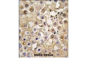 Formalin-fixed and paraffin-embedded human testis tissue reacted with ACE2 (SARS Receptor) Antibody (C-term) f , which was peroxidase-conjugated to the secondary antibody, followed by DAB staining. (ACE2 Antikörper  (C-Term))