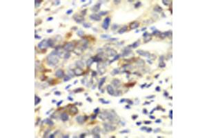 Immunohistochemistry of paraffin-embedded human colon carcinoma using APLP1 antibody (ABIN1871026) at dilution of 1:100 (40x lens). (APLP1 Antikörper)