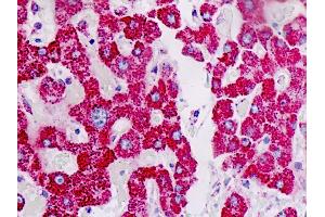 Anti-ACAT1 antibody IHC staining of human liver. (ACAT1 Antikörper)