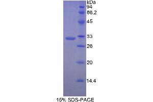 SDS-PAGE analysis of Human MYH7 Protein.