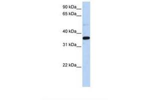 Image no. 1 for anti-Prostaglandin Reductase 1 (PTGR1) (N-Term) antibody (ABIN6739012) (PTGR1 Antikörper  (N-Term))