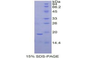 SDS-PAGE analysis of Rat Periostin Protein. (Periostin Protein (POSTN))