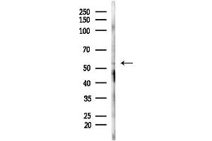 anti-Neutral Cholesterol Ester Hydrolase 1 (NCEH1) (N-Term) antibody