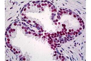 Anti-TRIM28 antibody IHC of human prostate. (KAP1 Antikörper  (AA 379-524))