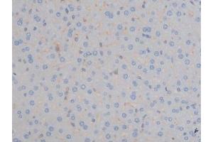 Immunohistochemistry (IHC) image for anti-Insulin-Like Growth Factor 1 Receptor (IGF1R) (pTyr1161) antibody (ABIN6256620)