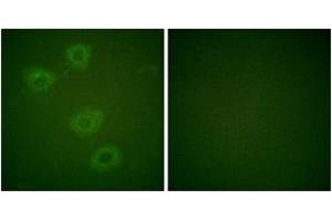 Immunofluorescence analysis of HuvEc cells, using Tyrosine Hydroxylase (Phospho-Ser19) Antibody. (Tyrosine Hydroxylase Antikörper  (pSer18))