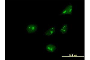 Immunofluorescence of purified MaxPab antibody to ARHGEF10 on HeLa cell. (ARHGEF10 Antikörper  (AA 1-380))