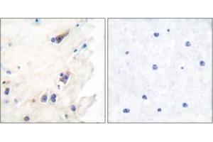 Immunohistochemistry analysis of paraffin-embedded human brain tissue, using PLCB3 (Ab-1105) Antibody. (PLCB3 Antikörper  (AA 1071-1120))