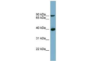 WB Suggested Anti-PNPLA8 Antibody Titration: 0. (PNPLA8 Antikörper  (Middle Region))