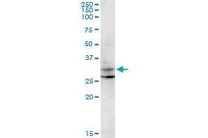 CENPP monoclonal antibody (M07), clone 3G8. (CENPP Antikörper  (AA 1-98))