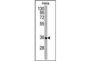 Western blot analysis using ATG5 Antibody (N-term) in Hela cell line lysates (35ug/lane). (ATG5 Antikörper  (N-Term))