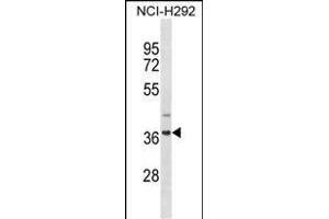 ZN Antibody (N-term) (ABIN1882033 and ABIN2838649) western blot analysis in NCI- cell line lysates (35 μg/lane). (ZNF696 Antikörper  (N-Term))