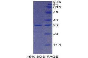 SDS-PAGE (SDS) image for Transferrin Receptor 2 (TFR2) (AA 211-405) protein (His tag) (ABIN1171483)