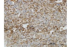 Immunoperoxidase of monoclonal antibody to IL31RA on formalin-fixed paraffin-embedded human spleen. (IL31RA Antikörper  (AA 21-120))