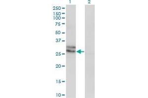 Western Blot analysis of EDN3 expression in transfected 293T cell line by EDN3 monoclonal antibody (M01), clone 2A6-2A4. (Endothelin 3 Antikörper  (AA 1-238))