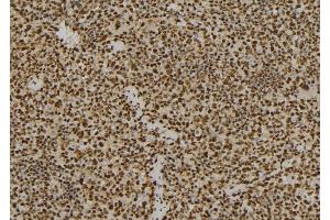 Immunohistochemistry (IHC) image for anti-Proteasome (Prosome, Macropain) 26S Subunit, Non-ATPase, 7 (PSMD7) (C-Term) antibody (ABIN6264491)