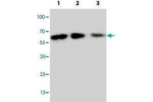 Western blot analysis of rbinate mouse Cx3cl1 protein with Cx3cl1 polyclonal antibody . (CX3CL1 Antikörper  (N-Term))