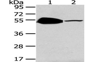 Western Blotting (WB) image for anti-TSPY-Like 1 (TSPYL1) antibody (ABIN5962132) (TSPYL1 Antikörper)