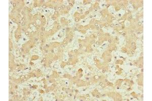 Immunohistochemistry of paraffin-embedded human liver tissue using ABIN7157665 at dilution of 1:100 (NUF2 Antikörper  (AA 165-464))