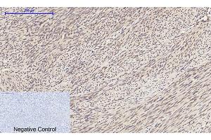 Immunohistochemical analysis of paraffin-embedded human uterus tissue. (ERK1/2 Antikörper  (AA 300-380))