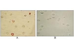 Immunocytochemistry analysis of TPA induced BCBL-1 cells (A) and uninduced BCBL-1 cells (B) using KSHV ORF45 mouse mAb with AEC staining. (KSHVORF45 Antikörper)