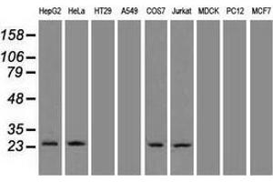 Western blot analysis of 35 µg of cell extracts from human brain tissue lysates using anti-NEUROG1 antibody. (Neurogenin 1 Antikörper)