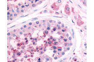 Anti-PDE3A antibody IHC of human testis. (PDE3A Antikörper  (N-Term))
