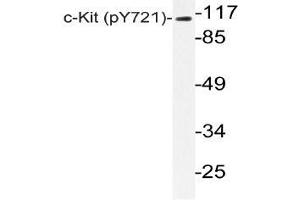 Western blot (WB) analyzes of p-c-Kit (pTyr721) antibody in extracts from HepG2 EGF cells. (KIT Antikörper  (pTyr721))
