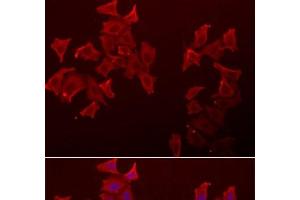 Immunofluorescence analysis of A549 cells using LECT1 Polyclonal Antibody (LECT1 Antikörper)