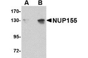 Western Blotting (WB) image for anti-Nucleoporin 155kDa (NUP155) (C-Term) antibody (ABIN1030553)