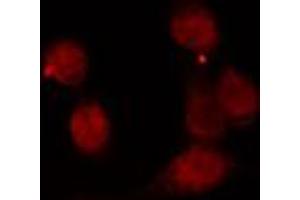 ABIN6274194 staining 293 cells by IF/ICC. (TBP Antikörper  (N-Term))