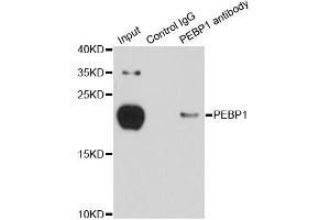 Immunoprecipitation analysis of 150ug extracts of MCF-7 cells using 3ug PEBP1 antibody.
