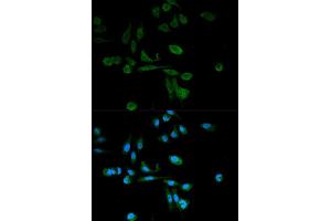 Immunofluorescence analysis of HeLa cell using SIRT7 antibody. (SIRT7 Antikörper  (AA 201-400))