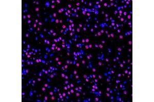 Immunofluorescence of paraffin embedded mouse kidney using GTF3C3 (ABIN7074039) at dilution of 1: 650 (400x lens) (GTF3C3 Antikörper)