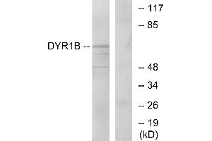 Western blot analysis of extracts from Jurkat cells, using DYR1B antibody. (DYRK1B Antikörper)