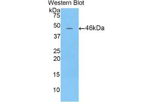 Western blot analysis of the recombinant protein. (Lipocalin 4 (LCN4) (AA 20-178) Antikörper)