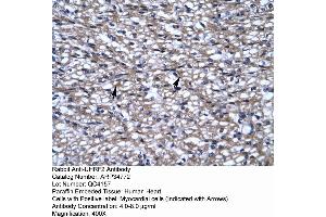Immunohistochemistry (IHC) image for anti-Ubiquitin-Like with PHD and Ring Finger Domains 2, E3 Ubiquitin Protein Ligase (UHRF2) (N-Term) antibody (ABIN2776012)
