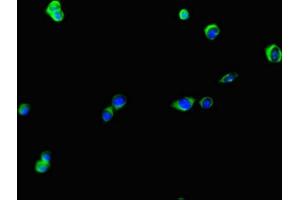 Immunofluorescent analysis of HepG2 cells using ABIN7174928 at dilution of 1:100 and Alexa Fluor 488-congugated AffiniPure Goat Anti-Rabbit IgG(H+L) (KIAA0513 Antikörper  (AA 1-301))