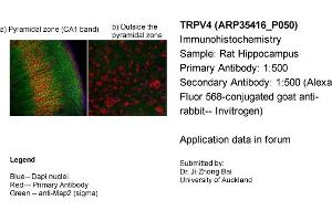 Immunohistochemistry (IHC) image for anti-Transient Receptor Potential Cation Channel, Subfamily V, Member 4 (TRPV4) (Middle Region) antibody (ABIN501411)
