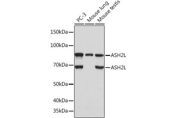 ASH2L Antikörper