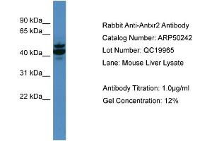 WB Suggested Anti-Antxr2  Antibody Titration: 0.