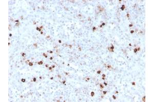 Formalin-fixed, paraffin-embedded human spleen stained with IgM Recombinant Rabbit Monoclonal Antibody (IGHM/3776R). (Rekombinanter IGHM Antikörper)