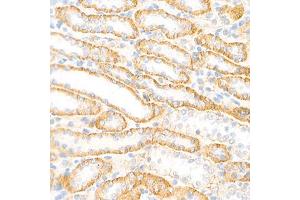 Immunohistochemistry analysis of paraffin-embedded rat kidney using,Cadherin 16 (ABIN7073265) at dilution of 1: 2000 (Cadherin-16 Antikörper)