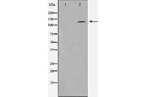 Western blot analysis on NIH-3T3 cell lysate using HDAC5 Antibody,The lane on the left is treated with the antigen-specific peptide. (HDAC5 Antikörper  (C-Term))