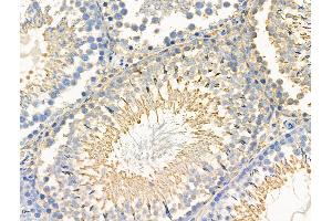 Phospho-Paxillin (Ser272) Antibody at 1/100 staining Rat testis tissue by IHC-P. (Paxillin Antikörper  (pSer272))
