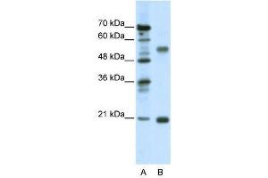 Western Blotting (WB) image for anti-Cholinergic Receptor, Nicotinic, beta 3 (Neuronal) (CHRNB3) (Middle Region) antibody (ABIN926966)
