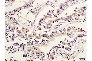 Immunohistochemistry (IHC) image for anti-HECT Domain and Ankyrin Repeat Containing, E3 Ubiquitin Protein Ligase 1 (HACE1) (AA 75-170) antibody (ABIN761141)