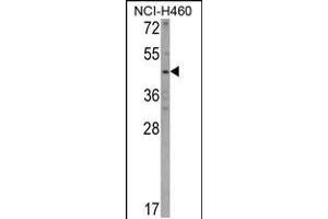Western blot analysis of KYNU Antibody in NCI-H460 cell line lysates (35ug/lane) (KYNU Antikörper  (C-Term))